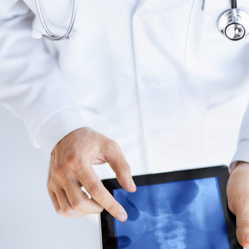 Ai Enabled X-Ray Detection of Lung Cancer