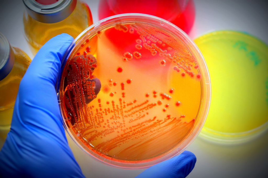 Facing a World without Antibiotics