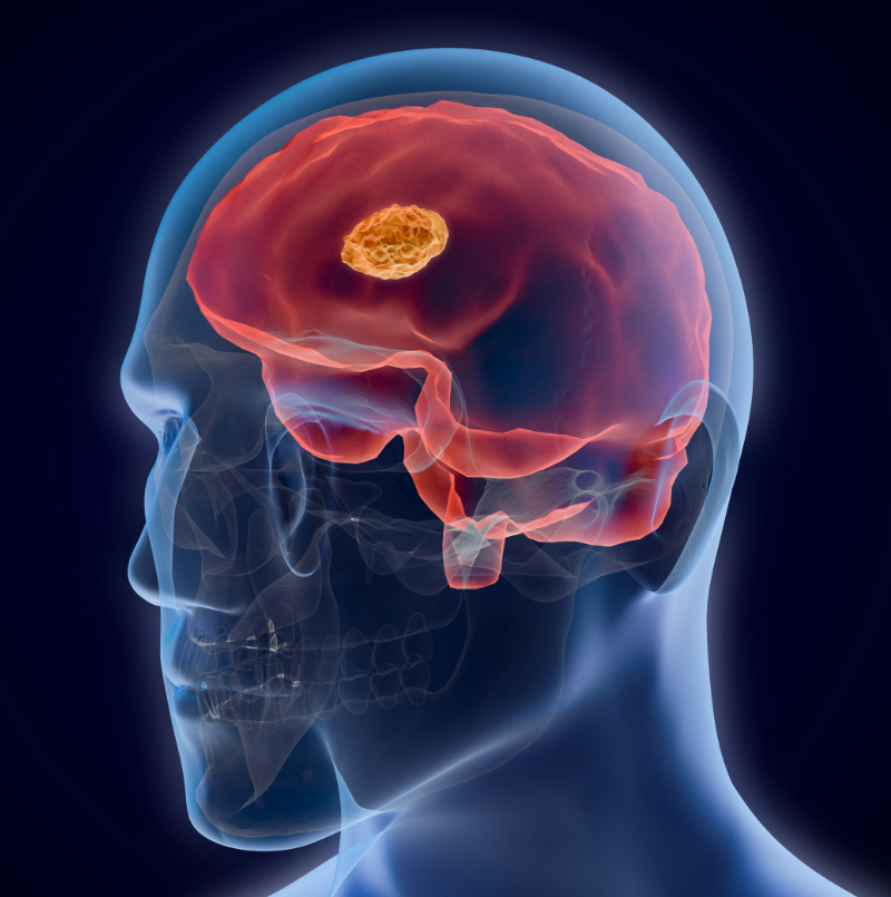 Making Healthy Brains a Global Priority